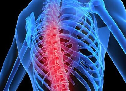 астэахандроз груднога аддзела хрыбетніка